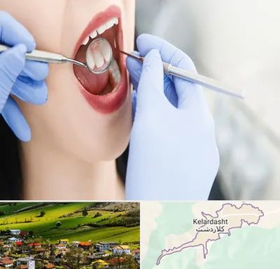 جراح دندان عقل در کلاردشت