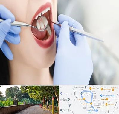 جراح دندان عقل در فلکه گاز رشت