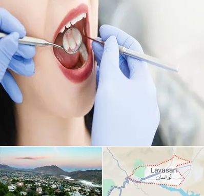 جراح دندان عقل در لواسان