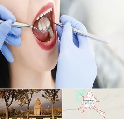 جراح دندان عقل در تویسرکان