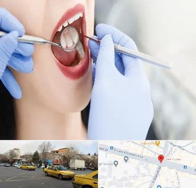 جراح دندان عقل در شهناز تبریز