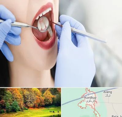 جراح دندان عقل در کردکوی