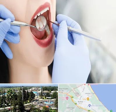 جراح دندان عقل در رودسر