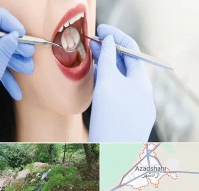 جراح دندان عقل در آزادشهر