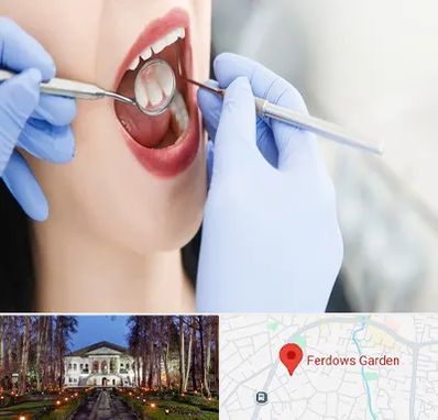 جراح دندان عقل در باغ فردوس