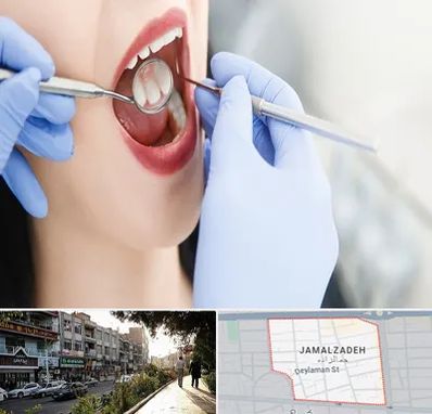 جراح دندان عقل در خیابان جمالزاده
