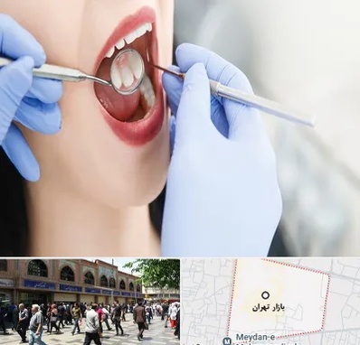 جراح دندان عقل در بازار تهران