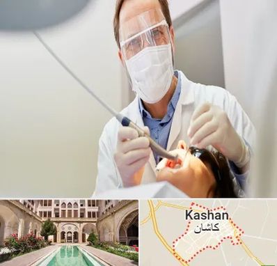 جراح لثه در کاشان