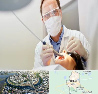 جراح لثه در بابل