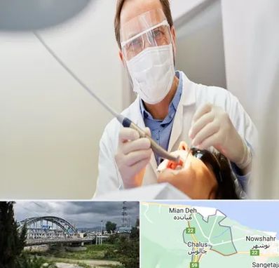 جراح لثه در چالوس