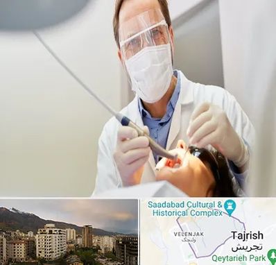 جراح لثه در زعفرانیه 