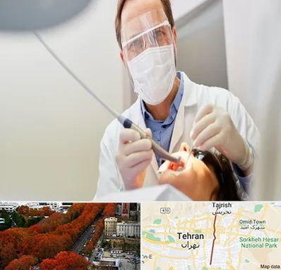 جراح لثه در ولیعصر 