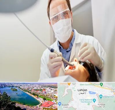 جراح لثه در لاهیجان