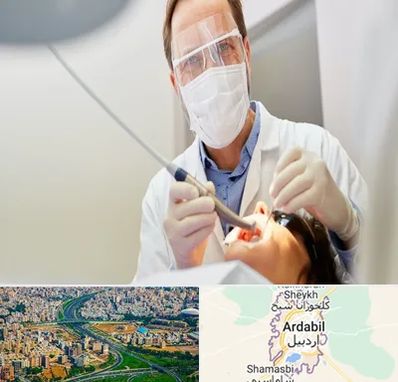 جراح لثه در اردبیل