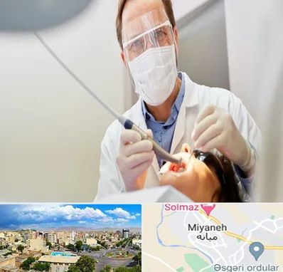 جراح لثه در میانه