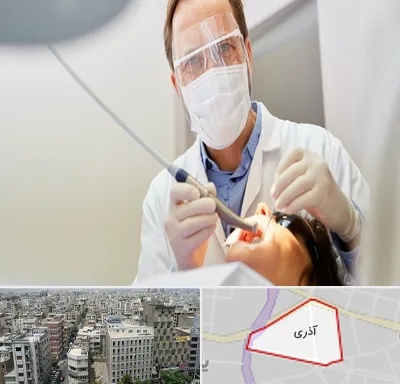 جراح لثه در آذری
