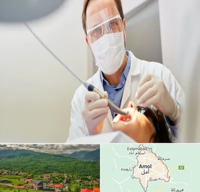 جراح لثه در آمل