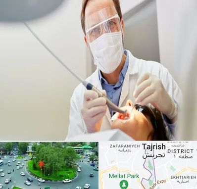 جراح لثه در تجریش 