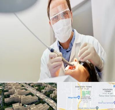 جراح لثه در اکباتان 