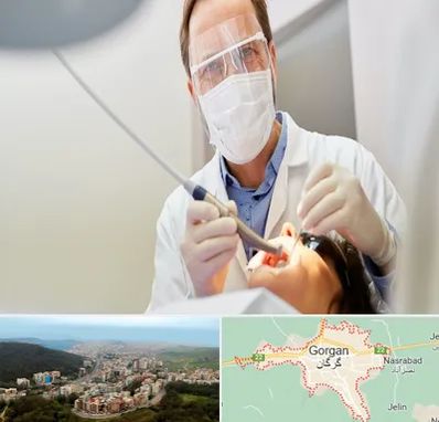 جراح لثه در گرگان