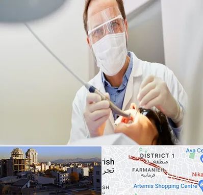 جراح لثه در فرمانیه 