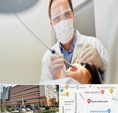 جراح لثه در سهروردی 