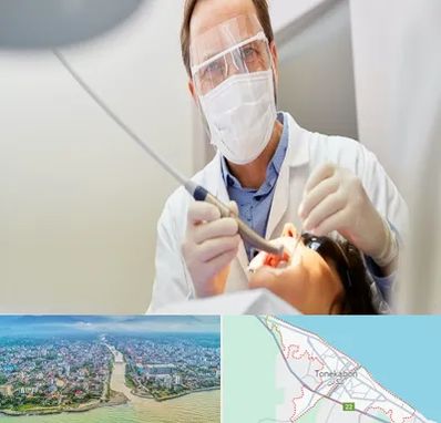 جراح لثه در تنکابن