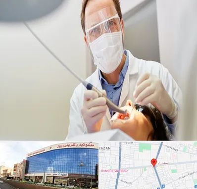 جراح لثه در نصف راه تبریز