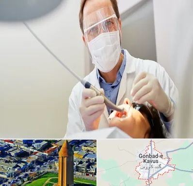 جراح لثه در گنبد کاووس