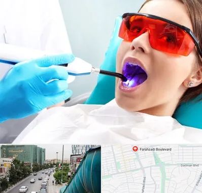جراحی لثه با لیزر در بلوار فرحزادی