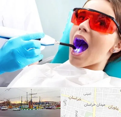 جراحی لثه با لیزر در میدان خراسان