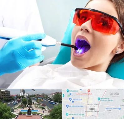 جراحی لثه با لیزر در بهارستان 