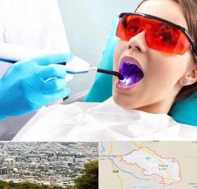 جراحی لثه با لیزر در یاسوج