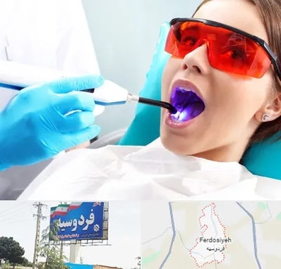 جراحی لثه با لیزر در فردوسیه شهریار