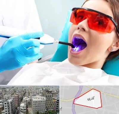 جراحی لثه با لیزر در آذری