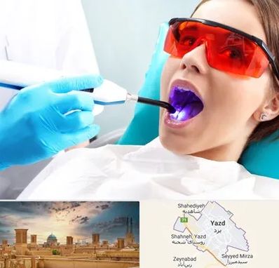 جراحی لثه با لیزر در یزد