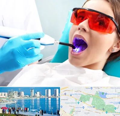 جراحی لثه با لیزر در چیتگر 