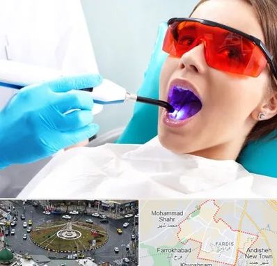 جراحی لثه با لیزر در فردیس کرج 