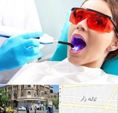جراحی لثه با لیزر در لاله زار