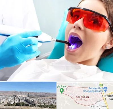 جراحی لثه با لیزر در شهرک گلستان شیراز