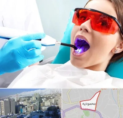 جراحی لثه با لیزر در محمودیه