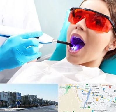 جراحی لثه با لیزر در شریعتی مشهد