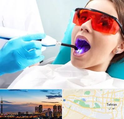 جراحی لثه با لیزر در غرب تهران 