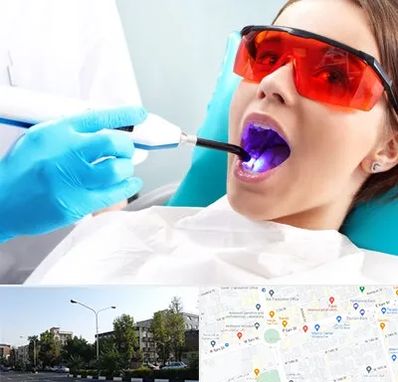 جراحی لثه با لیزر در میدان کاج