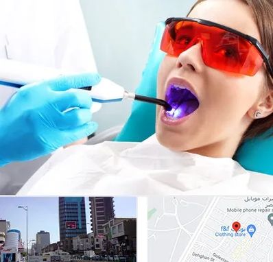 جراحی لثه با لیزر در چهارراه طالقانی کرج