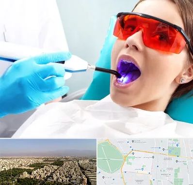 جراحی لثه با لیزر در نازی آباد