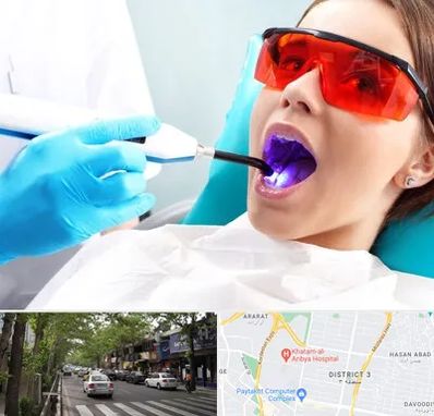 جراحی لثه با لیزر در ظفر 