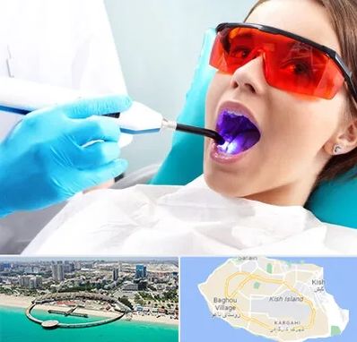 جراحی لثه با لیزر در کیش