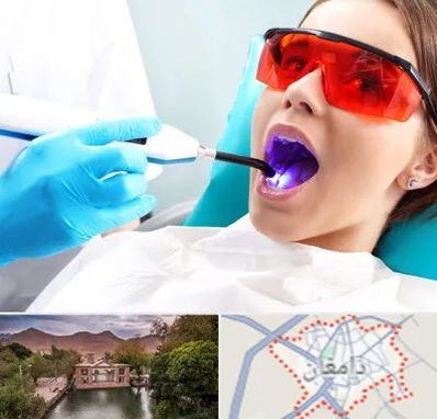 جراحی لثه با لیزر در دامغان