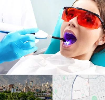 جراحی لثه با لیزر در جمشیدیه